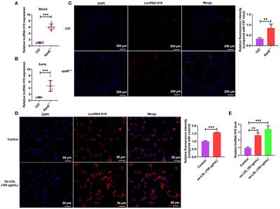 The Pathogenic Role of Long Non-coding RNA H19 in Atherosclerosis via the miR-146a-5p/ANGPTL4 Pathway